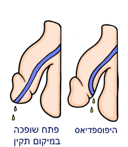 מצב צד של הפין