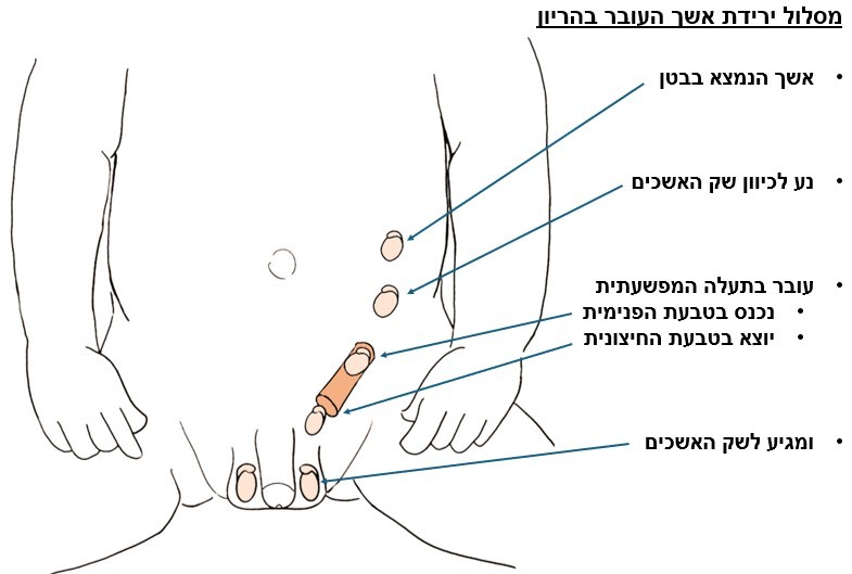 אשך טמיר